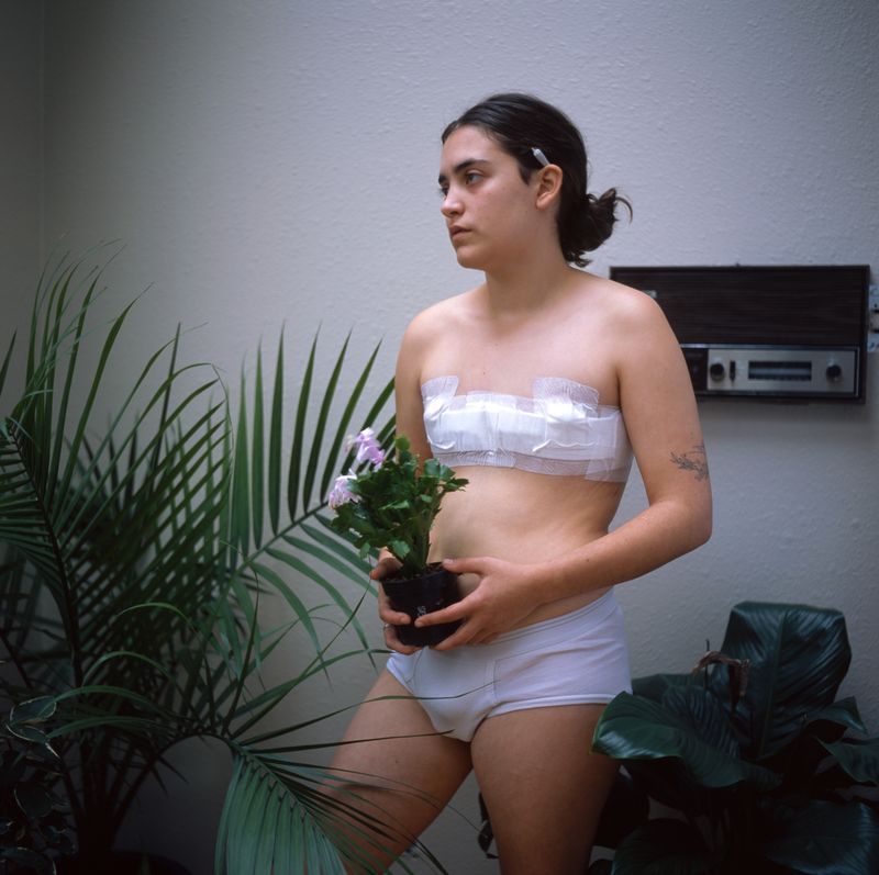 © Lauren Hare - Nic post op