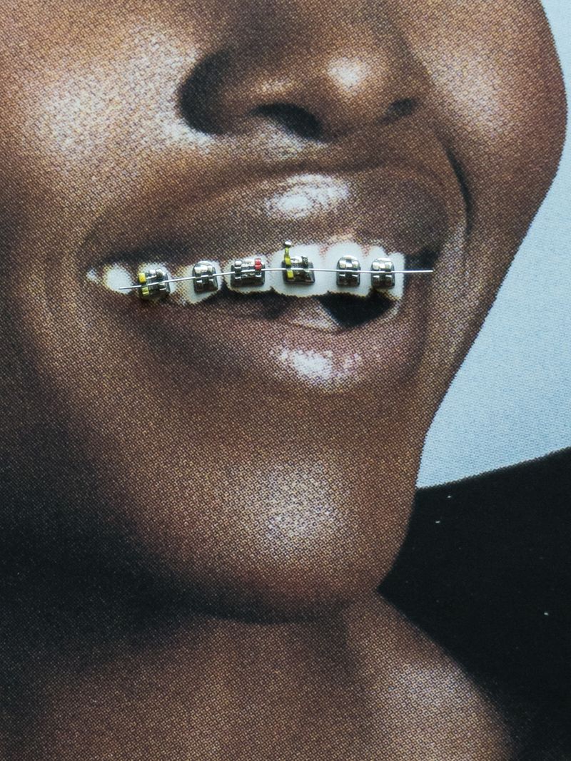 © Yiding Chen - Image from the Orthodontics Ceremony photography project