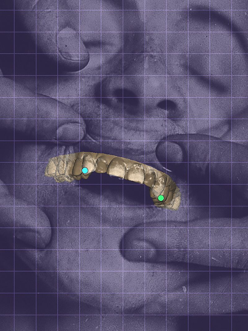 © Yiding Chen - Image from the Orthodontics Ceremony photography project