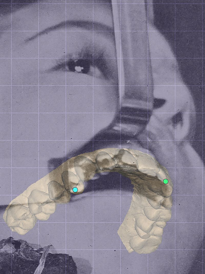 © Yiding Chen - Image from the Orthodontics Ceremony photography project