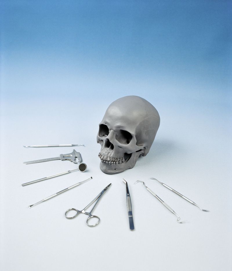 © Yiding Chen - Image from the Orthodontics Ceremony photography project