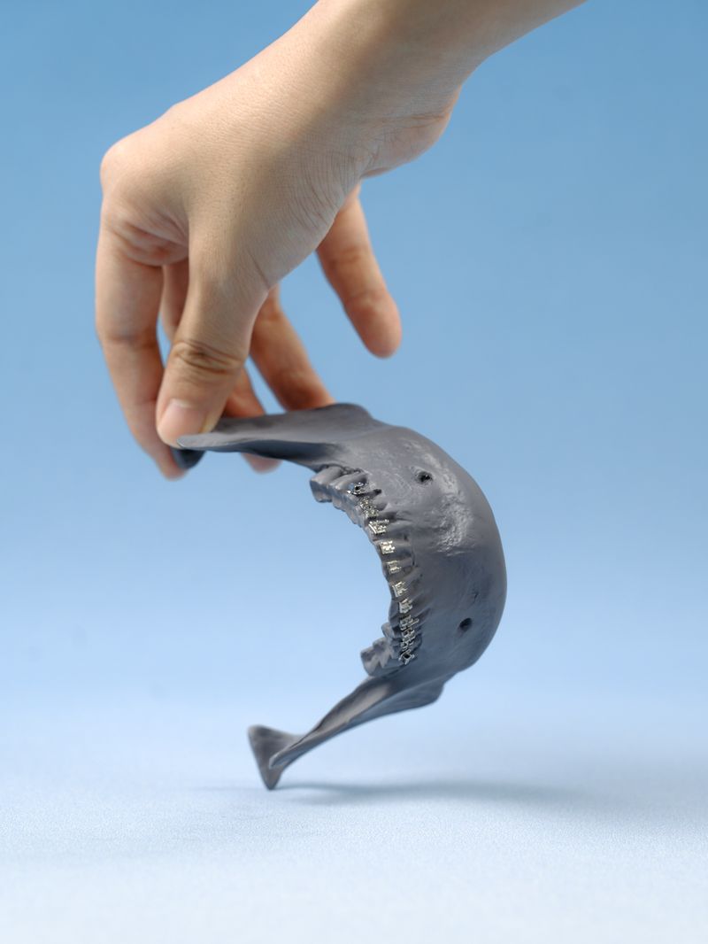 © Yiding Chen - Image from the Orthodontics Ceremony photography project