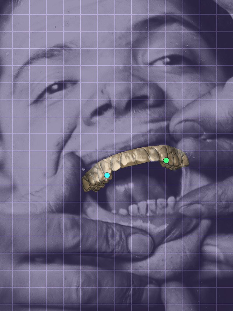 © Yiding Chen - Image from the Orthodontics Ceremony photography project