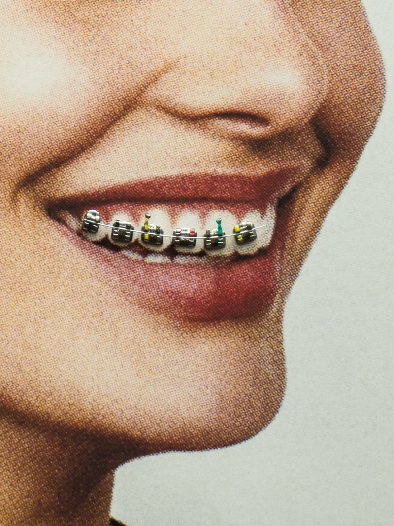 © Yiding Chen - Image from the Orthodontics Ceremony photography project