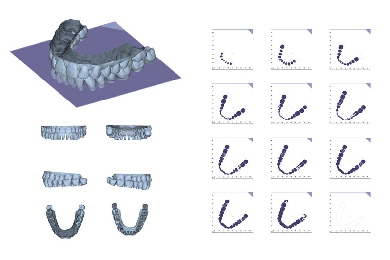© Yiding Chen - Image from the Orthodontics Ceremony photography project