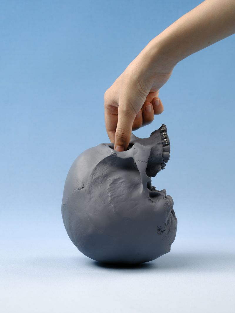 © Yiding Chen - Image from the Orthodontics Ceremony photography project