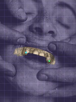 Orthodontics Ceremony