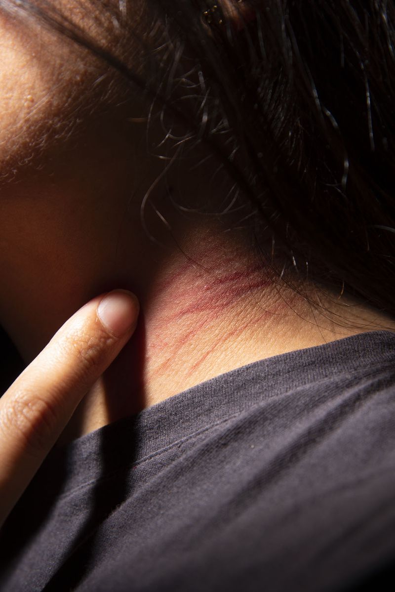 © Eleana Konstantellos André - #2 victim of the chupacabras