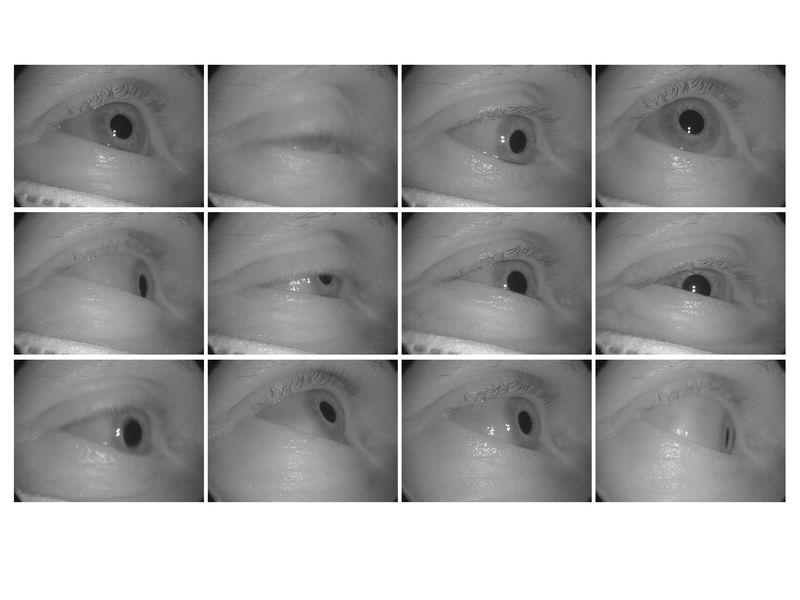 © Mattia Balsamini - Rapid - eye - movement tests at the Center for Chronobiology UPK in Basel.