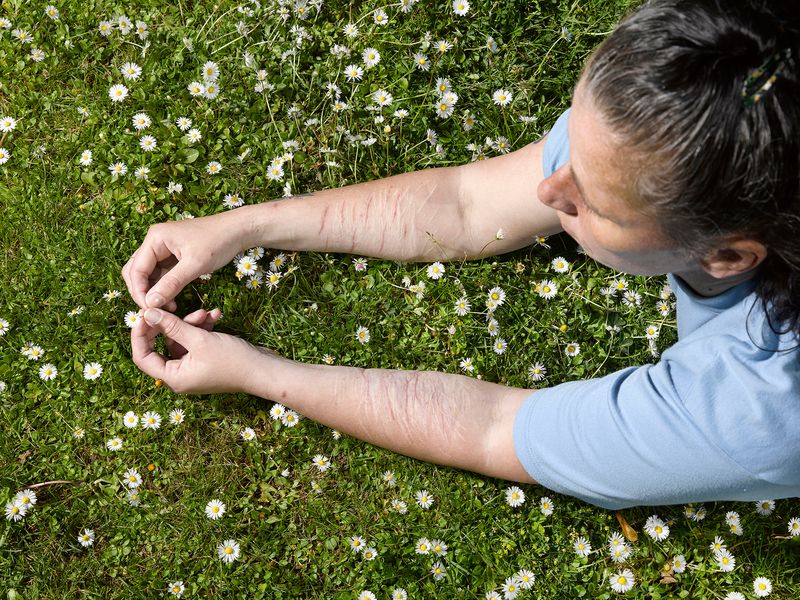 © Richard Ansett - Janine with Daisies