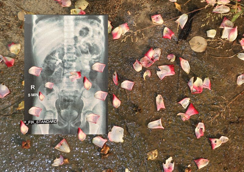 © masoumeh bahrami - Image from the All those nails were too much for my eyes photography project