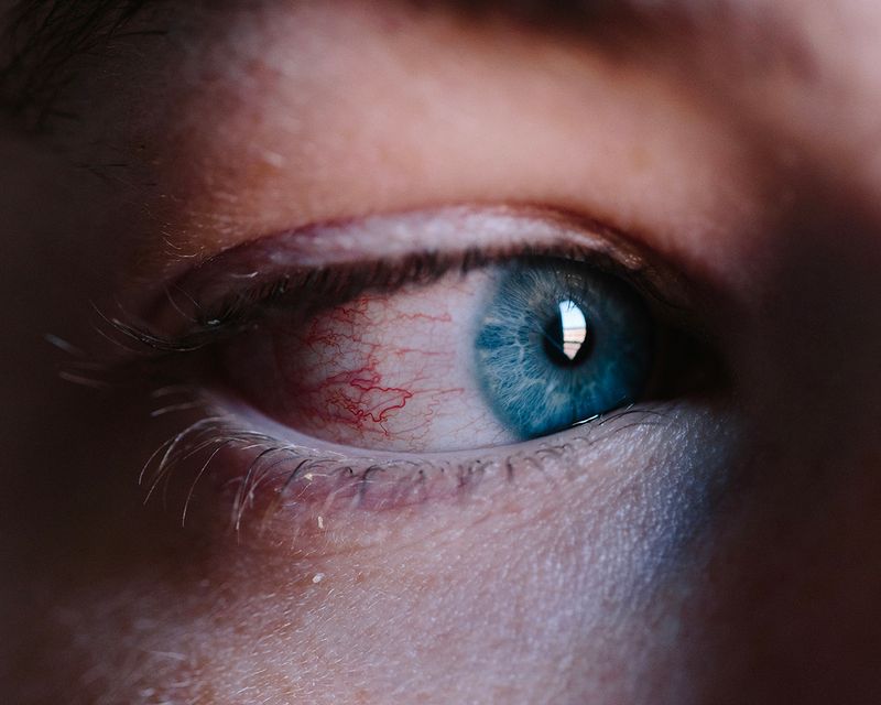 © Olivia Phare - Bloodshot, 2019 // Digital Photograph