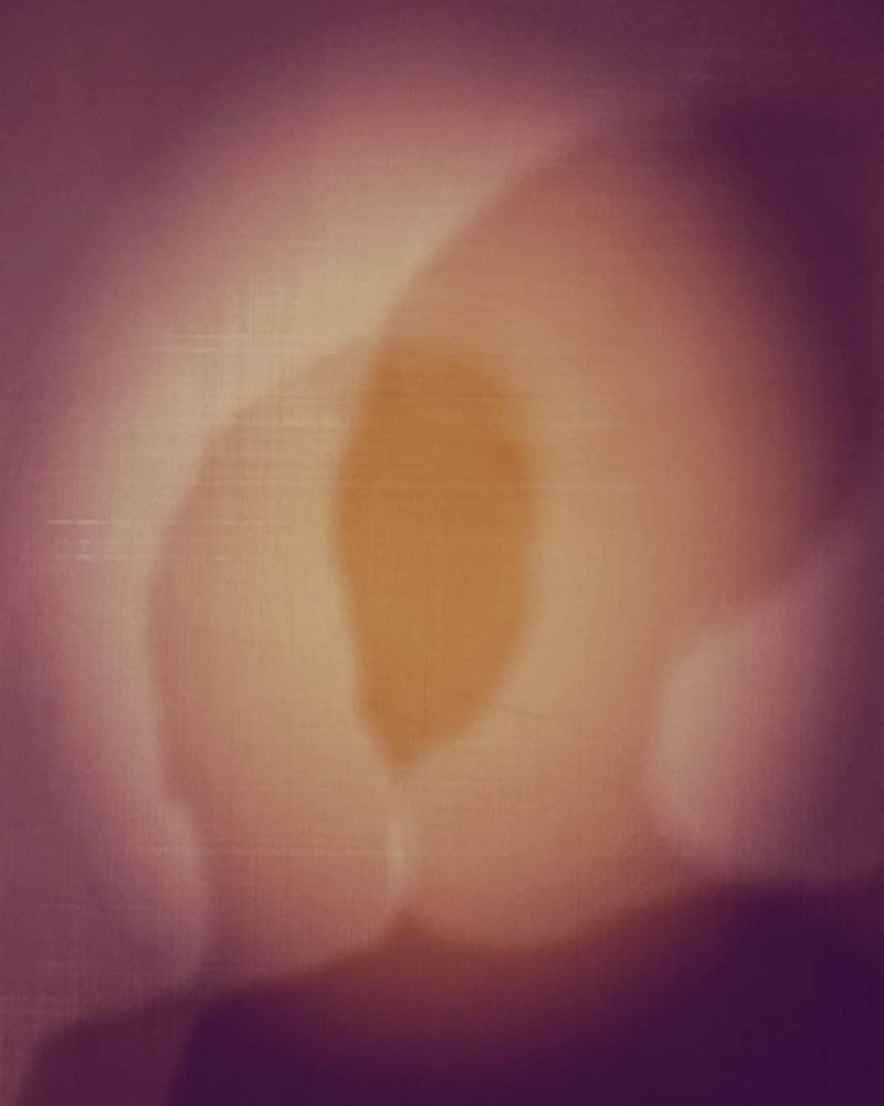© Viktoria Binges - There's a me “before my brain surgery” and “after.”