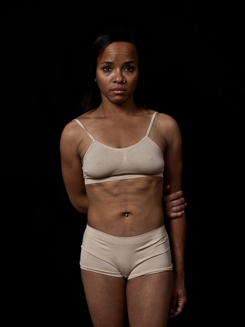 © Henrietta Soininen - Image from the Skin color (Color piel) photography project