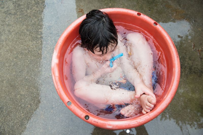 © Karen Haberberg - Image from the An Ordinary Day - Kids with Rare Genetic Conditions photography project