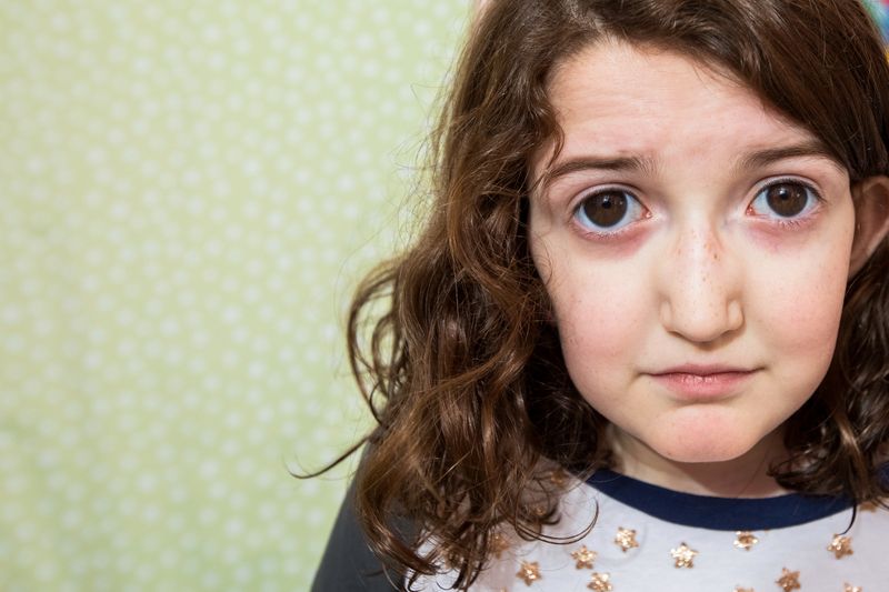 © Karen Haberberg - CASSIE’S MARFAN SYNDROME COULD HAVE BEEN FATAL IF DOCTORS HAD NOT CAUGHT IT IN TIME.