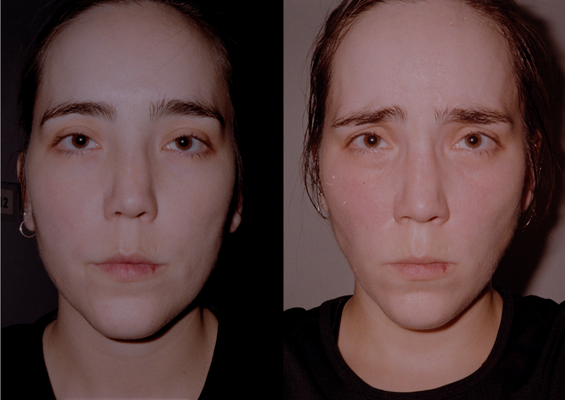 © Fernanda Requena - Image from the PAIN photography project