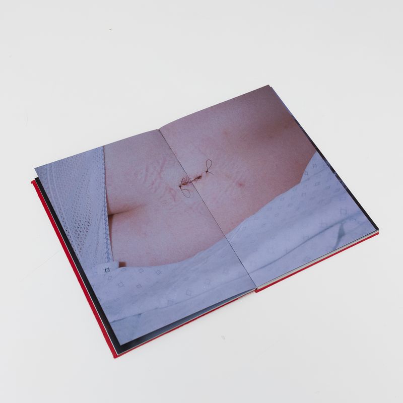 © Fernanda Requena - Image from the PAIN photography project