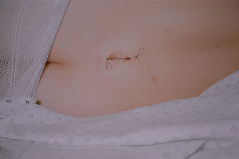 © Fernanda Requena - Image from the PAIN photography project
