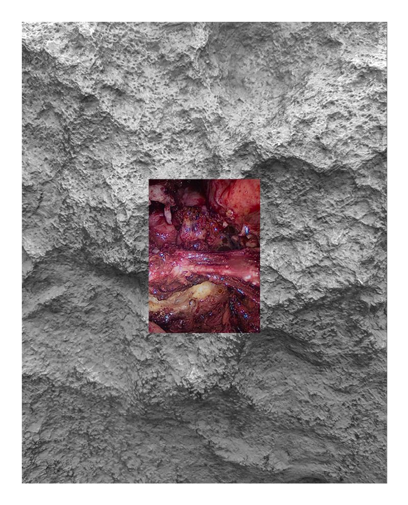 © carola cunzolo - Image from the Witness photography project