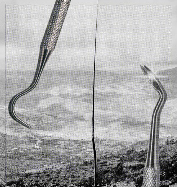 © MAryam Touzani - Dental tools collaged over the Atlas mountains, the mouth as landscape, the tongue as terrain.
