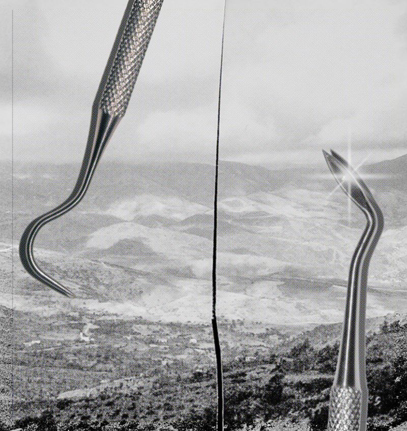 © MAryam Touzani - Dental tools collaged over the Atlas mountains, the mouth as landscape, the tongue as terrain.
