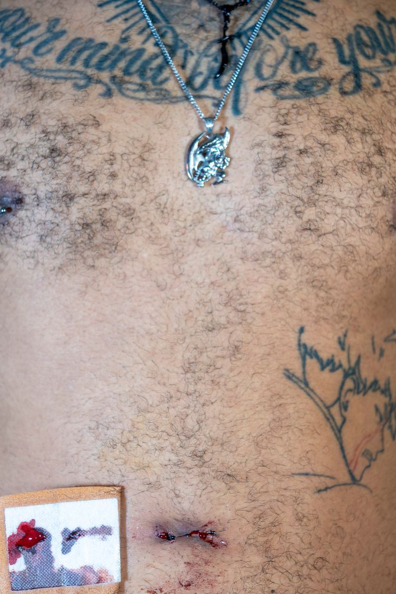 © André Ramos-Woodard - WOUNDED