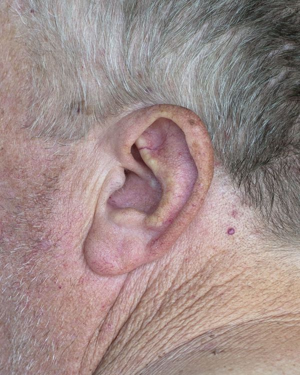 © Chloe Scout Nix - dad ear, 2023. 32x40 in. fabric coated vinyl paper.