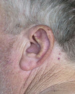 earchive