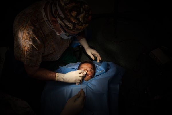 © Anneke Paterson - An infant receives the final steps in his cleft palate procedure. Veracruz, México, 2014.
