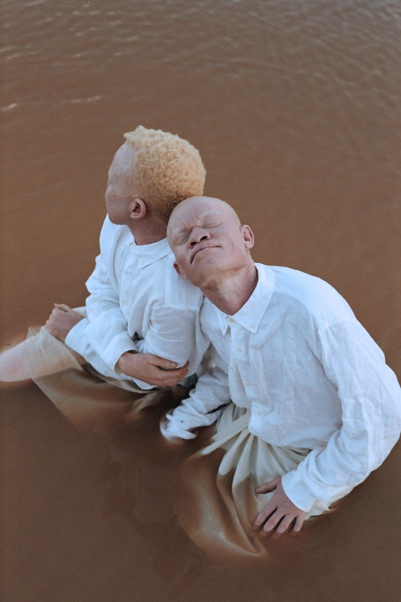 © Denisse Ariana Pérez - Image from the "Albinism, Albinism" Part I & II photography project