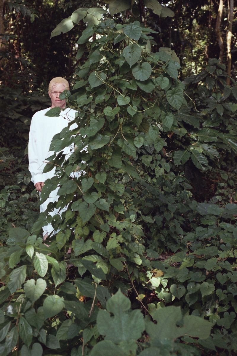 © Denisse Ariana Pérez - Image from the "Albinism, Albinism" Part I & II photography project