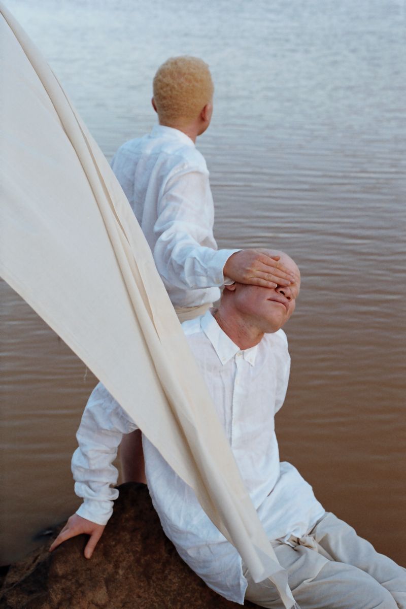 © Denisse Ariana Pérez - Image from the "Albinism, Albinism" Part I & II photography project