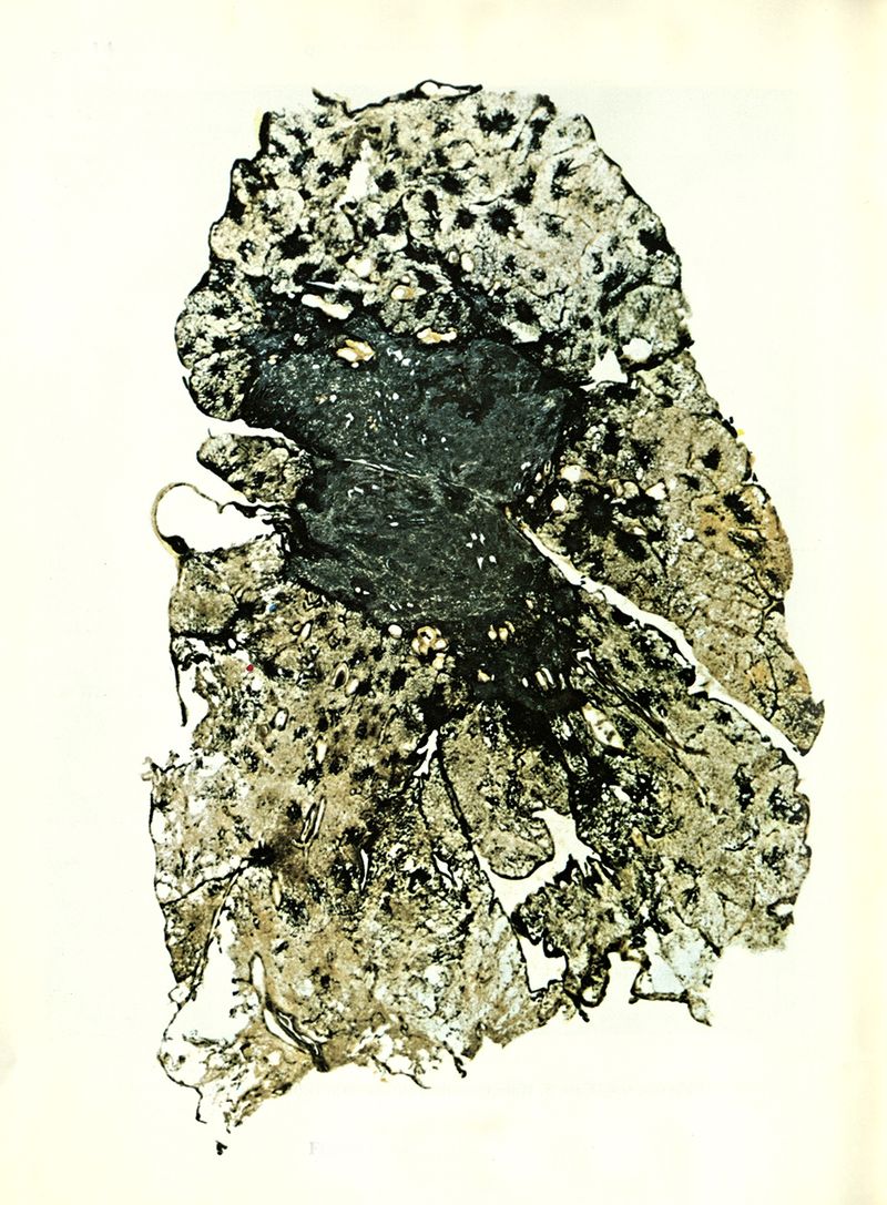 © Stacy Kranitz - Pneumoconiosis Illustration, 2017