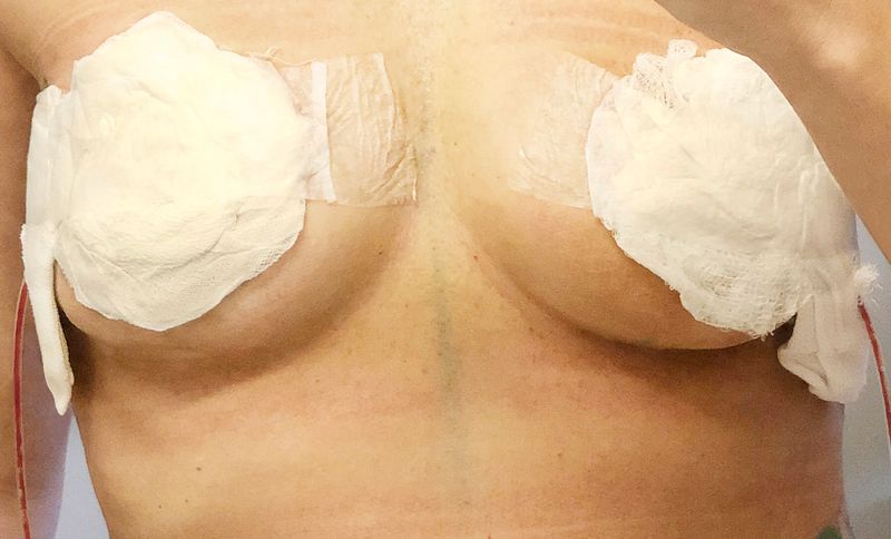 © Grace Hoyle - Image from the The Heal is Real photography project