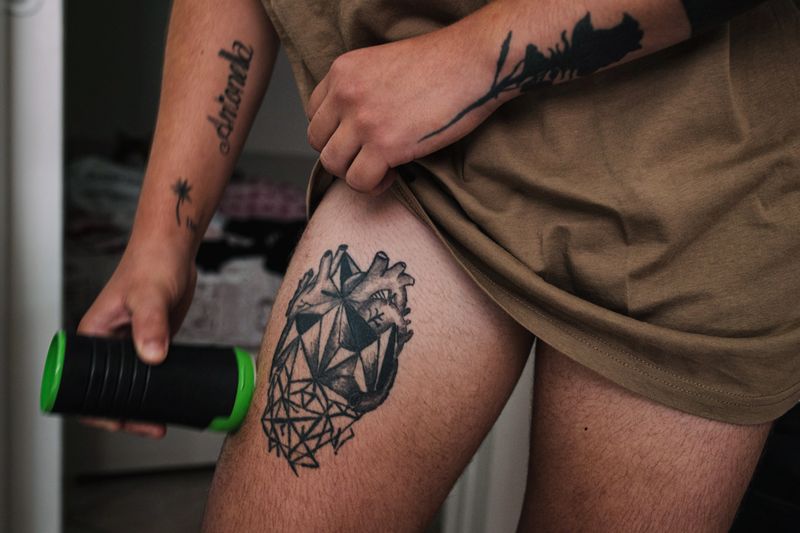 © Diana Bagnoli - Salvatore applies testosterone gel on his leg, a hormone treatment that he cannot do without and must use every day.