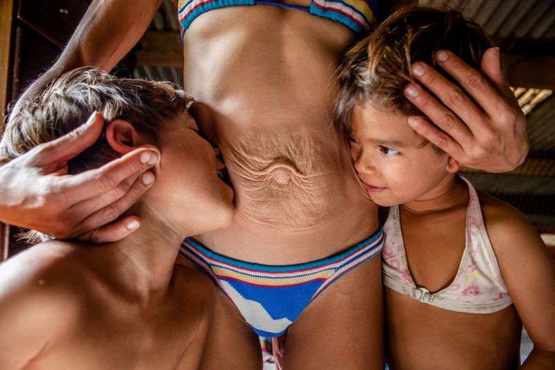 © Leticia Valverdes - Image from the BIRTH MARKS- OBSTETRIC VIOLENCE IN BRAZIL, A CONTEMPORARY HUMAN RIGHTS ISSUE photography project