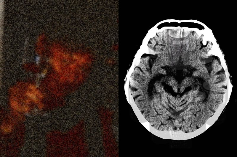 © Yusuke Takagi - My father and his brain image.