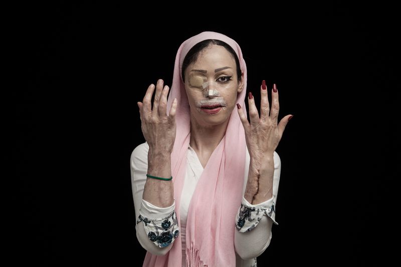 © Asghar Khamseh, from the series Fire of Hatred. 2016 L’Iris d’Or Winner, Sony World Photography Awards