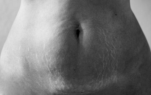 © info@maudearsenault.com Arsenault - Mon ventre craquée, 2024