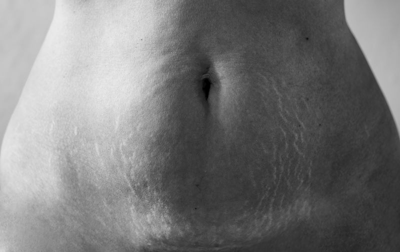 © info@maudearsenault.com Arsenault - Mon ventre craquée, 2024