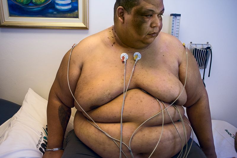 © Silvia Landi - Image from the Globesity photography project