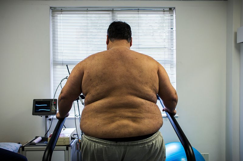 © Silvia Landi - Image from the Globesity photography project