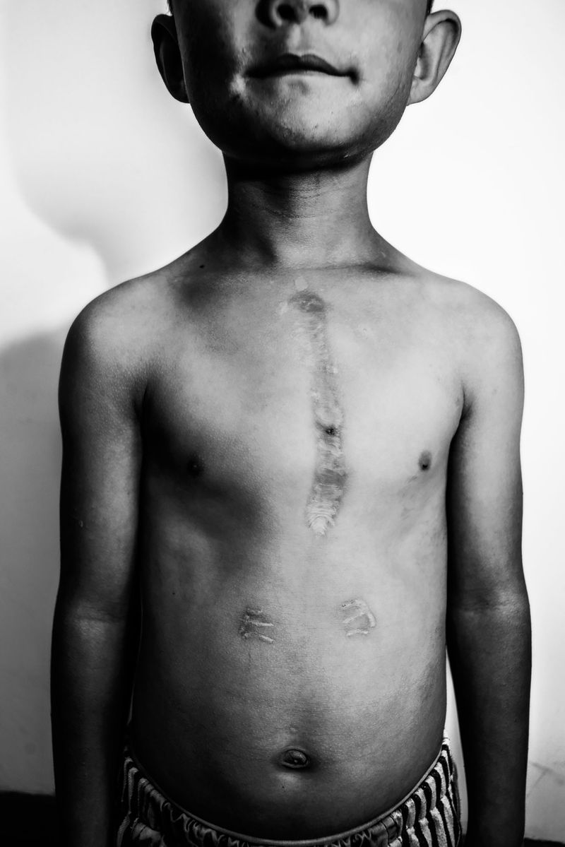 © Jin TIAN - Image from the Wild Grass --- China's Orphans photography project