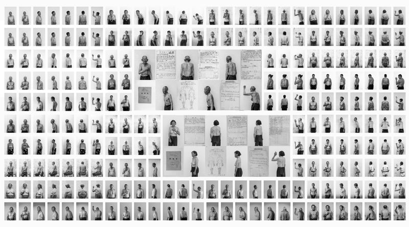 © Jin TIAN - Image from the CURSE OF THE WIND. A HISTORY OF LEPROSY IN CHIN photography project