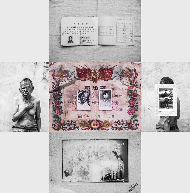 © Jin TIAN - Image from the CURSE OF THE WIND. A HISTORY OF LEPROSY IN CHIN photography project