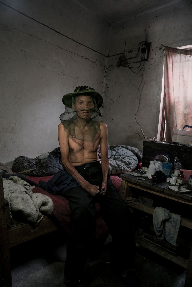 © Jin TIAN - The veil and beekeeper are two symbols of leprosy, They can keep them away from the crowd and help them live alone.