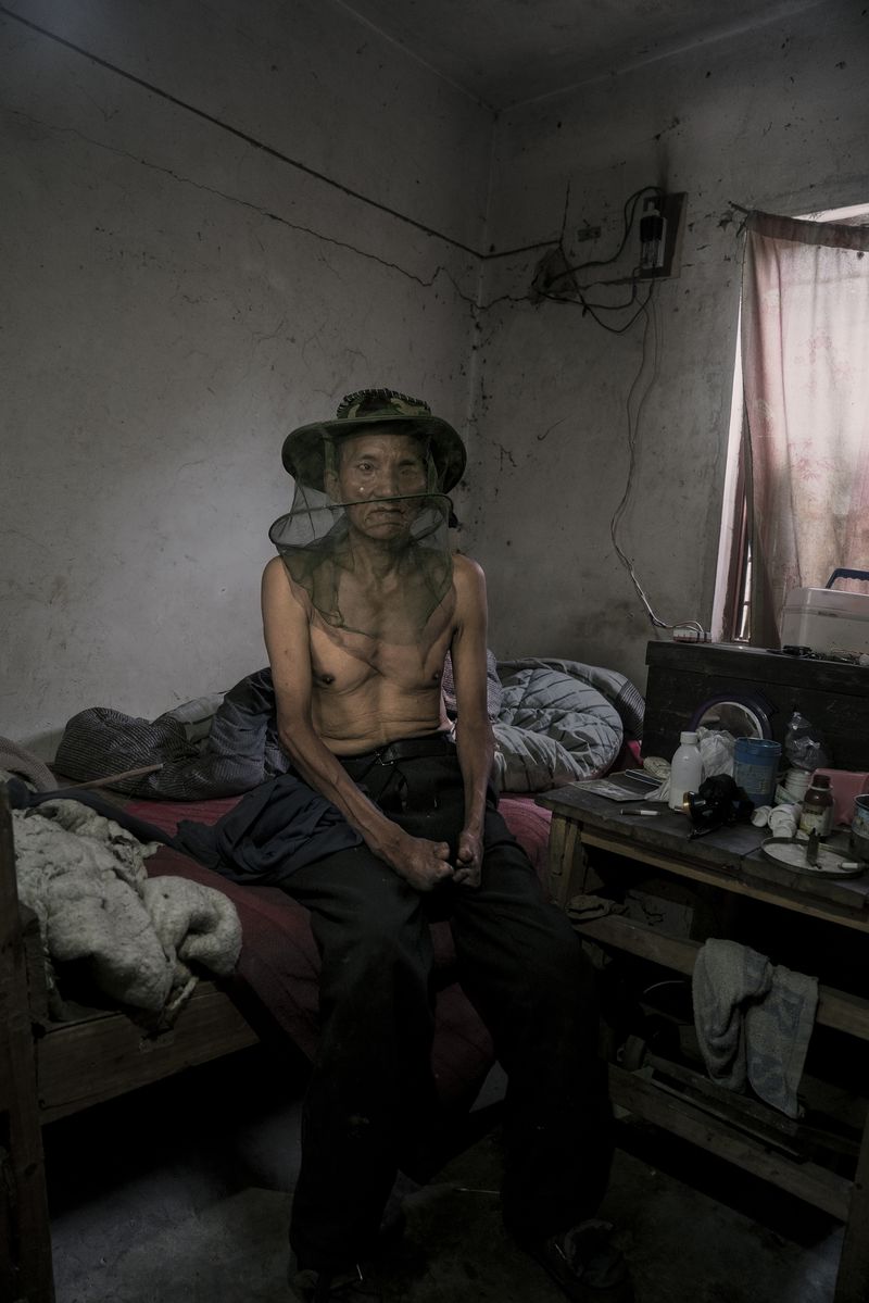 © Jin TIAN - The veil and beekeeper are two symbols of leprosy, They can keep them away from the crowd and help them live alone.
