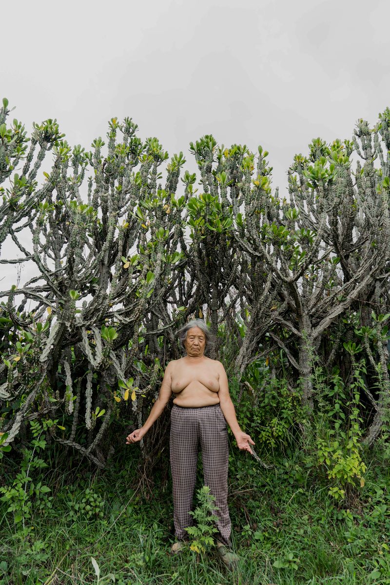 © Jin TIAN - Image from the CURSE OF THE WIND. A HISTORY OF LEPROSY IN CHIN photography project