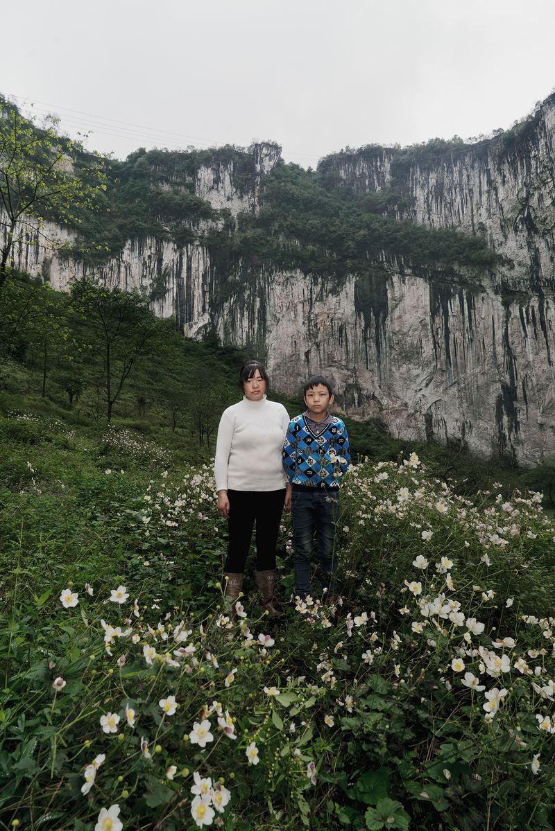 © Jin TIAN - A pair of mother and son in Leprosy Village